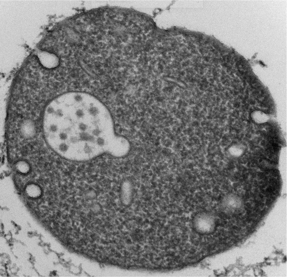 Electron micrograph of a multi-compartmented microvesicle.