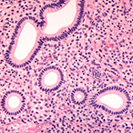 Cross-section of endometrial tissue.