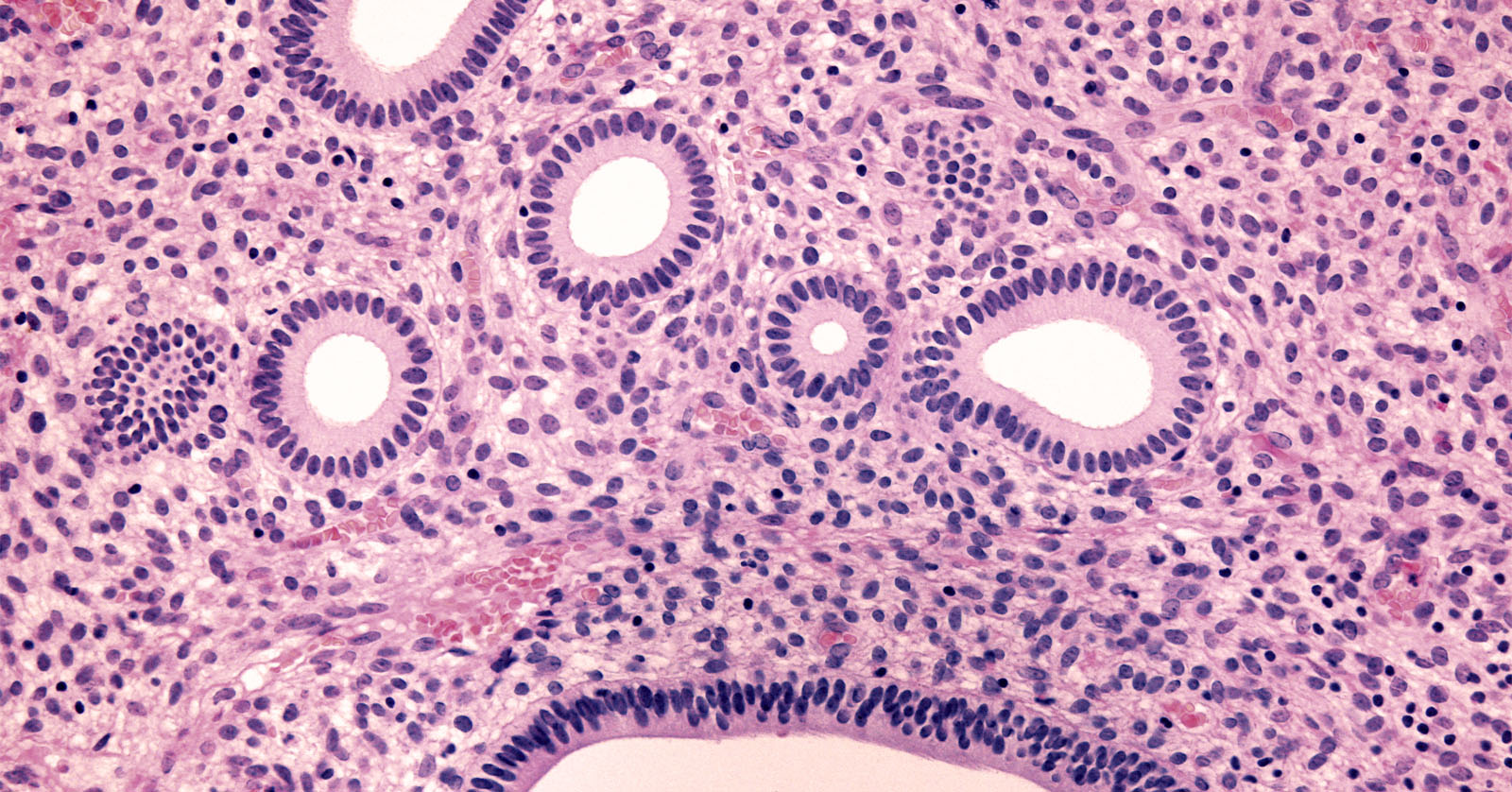 Cross-section of endometrial tissue.