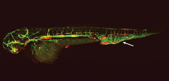 Zebrafish with fluorescently labeled lymphatic and blood vessels and vascular malformation in the tail.