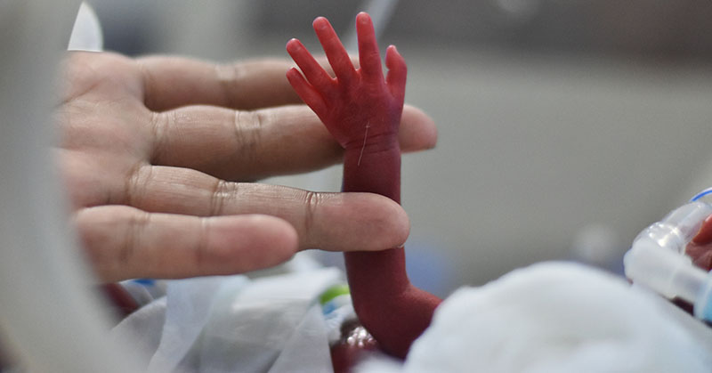 Adult hand holding tiny hand of preterm infant.
