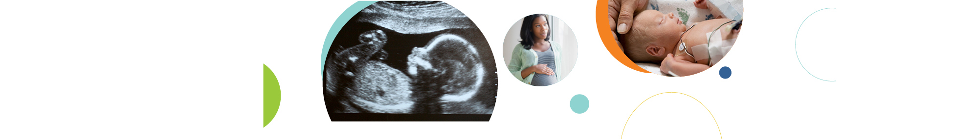 A series of three circular images related to preterm birth, including an ultrasound image (left), a pregnant person (center), and a newborn in a hospital bassinet (right). 
