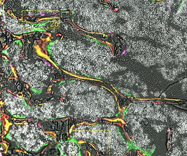Histology section with green, magenta, yellow, and orange highlights interspersed against a greyscale background.