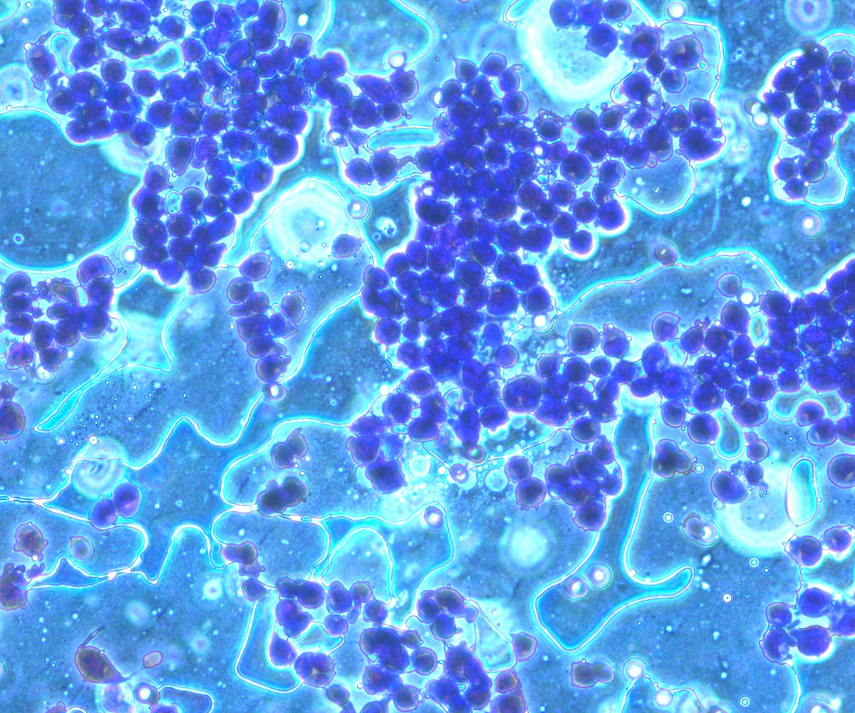  Dark blue cells clump alongside lighter blue cells.