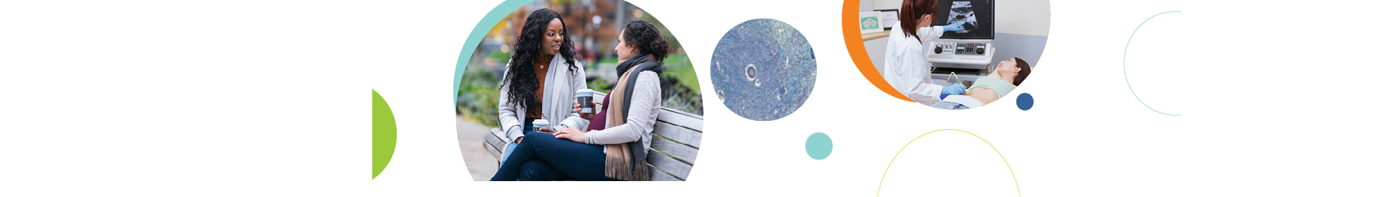 A series of three circular images related to uterine fibroids, including two women sitting on a bench, holding coffee cups, and engaged in conversation (left), a microscopic slide showing the cellular structure of uterine fibroids (center), and a medical professional performing an ultrasound examination on a patient (right). 