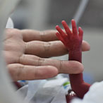 Adult hand holding a tiny preterm infant’s hand.