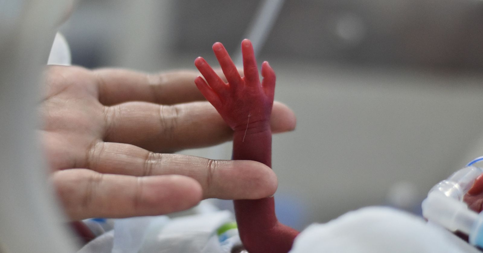 Adult hand holding a tiny preterm infant’s hand.