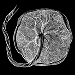 A black and white rendering of a placenta and cord against a black background.