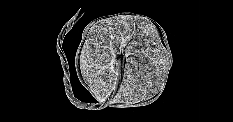 A black and white rendering of a placenta and cord against a black background.