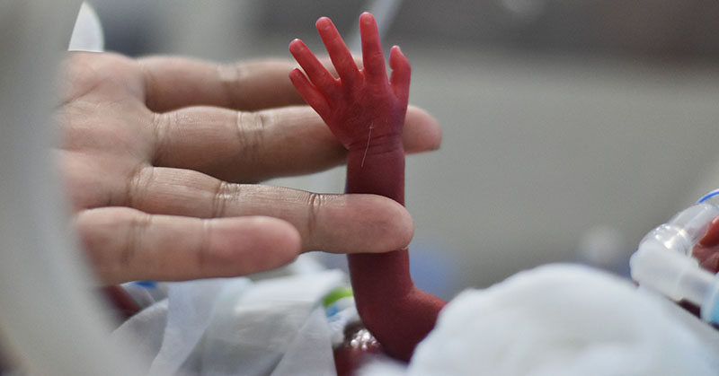 Preterm infant’s tiny hand.