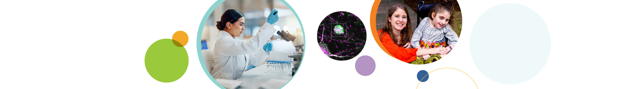 A series of three circular images related to rare diseases. The first image (left) shows a scientist in the lab at a microscope. The middle image shows an axon swelling in BORC-depleted neurons, which can contribute to neurodegenerative diseases. The third image (right) shows a caregiver and their child who has Rett Syndrome. The images are surrounded by colorful, overlapping circles in green, orange, purple, and blue.