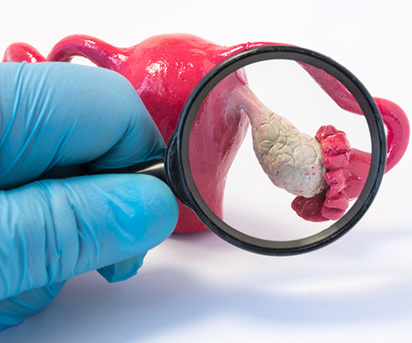 Gloved hand holding a magnifying glass to examine a plastic model of an ovary.