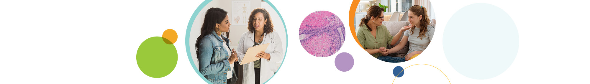 A series of three circular images focused on endometriosis. The first image (left) shows a health care provider showing a patient a clipboard. The center image is a micrograph of endometriosis stained in pink and purple. The third image (right) is of a caregiver comforting their teen child. The images are surrounded by colorful, overlapping circles in green, orange, purple, and blue.