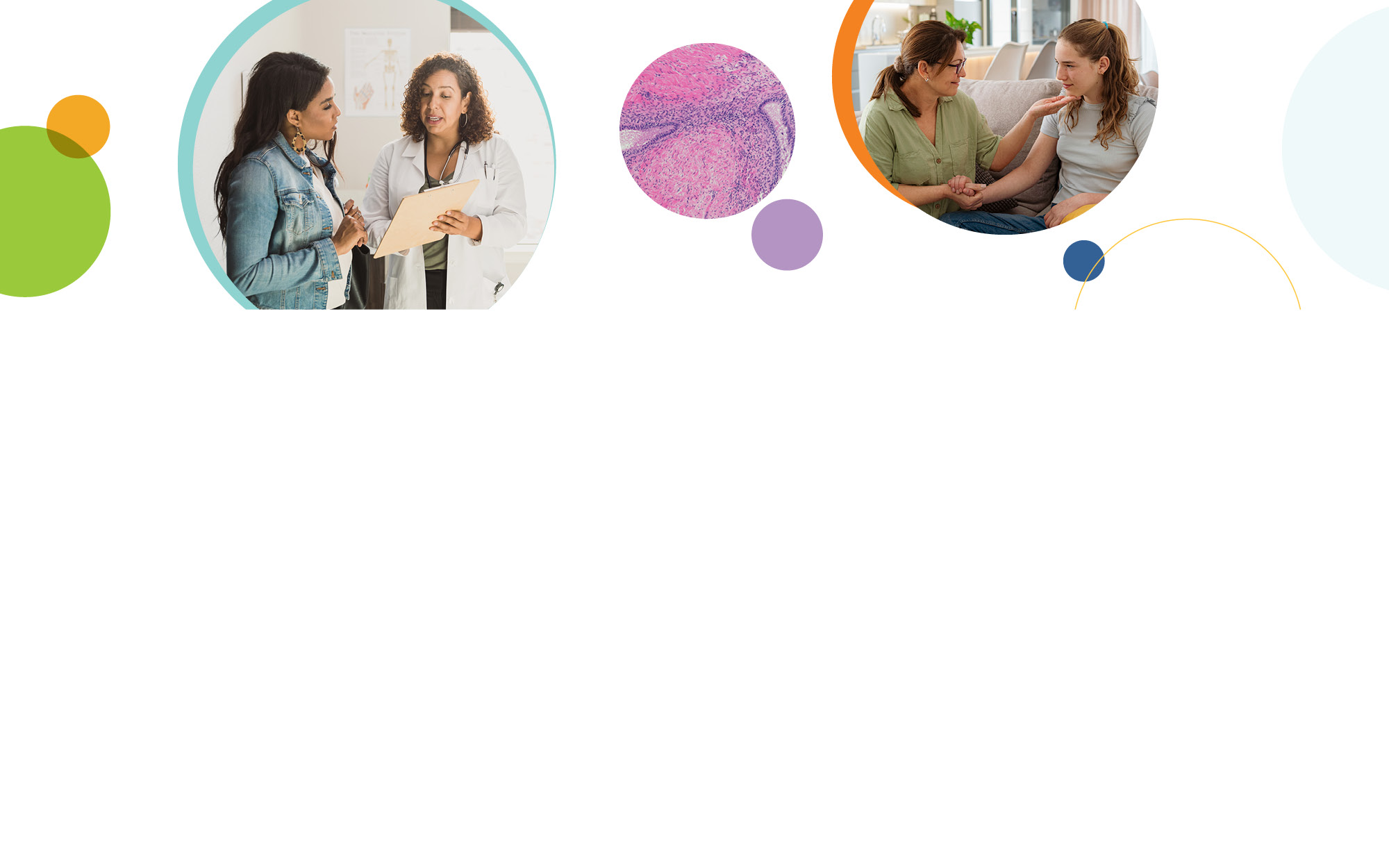 A series of three circular images focused on endometriosis. The first image (left) shows a health care provider showing a patient a clipboard. The center image is a micrograph of endometriosis stained in pink and purple. The third image (right) is of a caregiver comforting their teen child. The images are surrounded by colorful, overlapping circles in green, orange, purple, and blue.