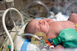 Newborn human baby lays in an incubator with oxegen and monitoring equipment.