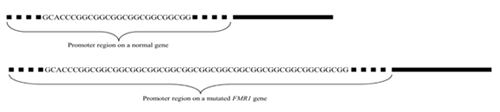 Graphic showing the promoter region on a normal gene versus on a mutated FMR1 gene