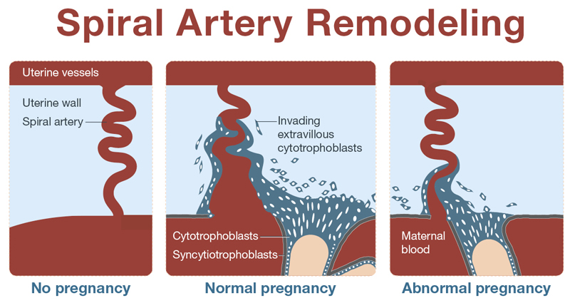 Spiral Artery Remodeling