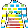 Diagram of bodily areas where women reported feeling pain.
