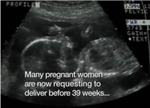 Sonogram with text "Many pregnant women are now requesting to deliver before 39 weeks..."